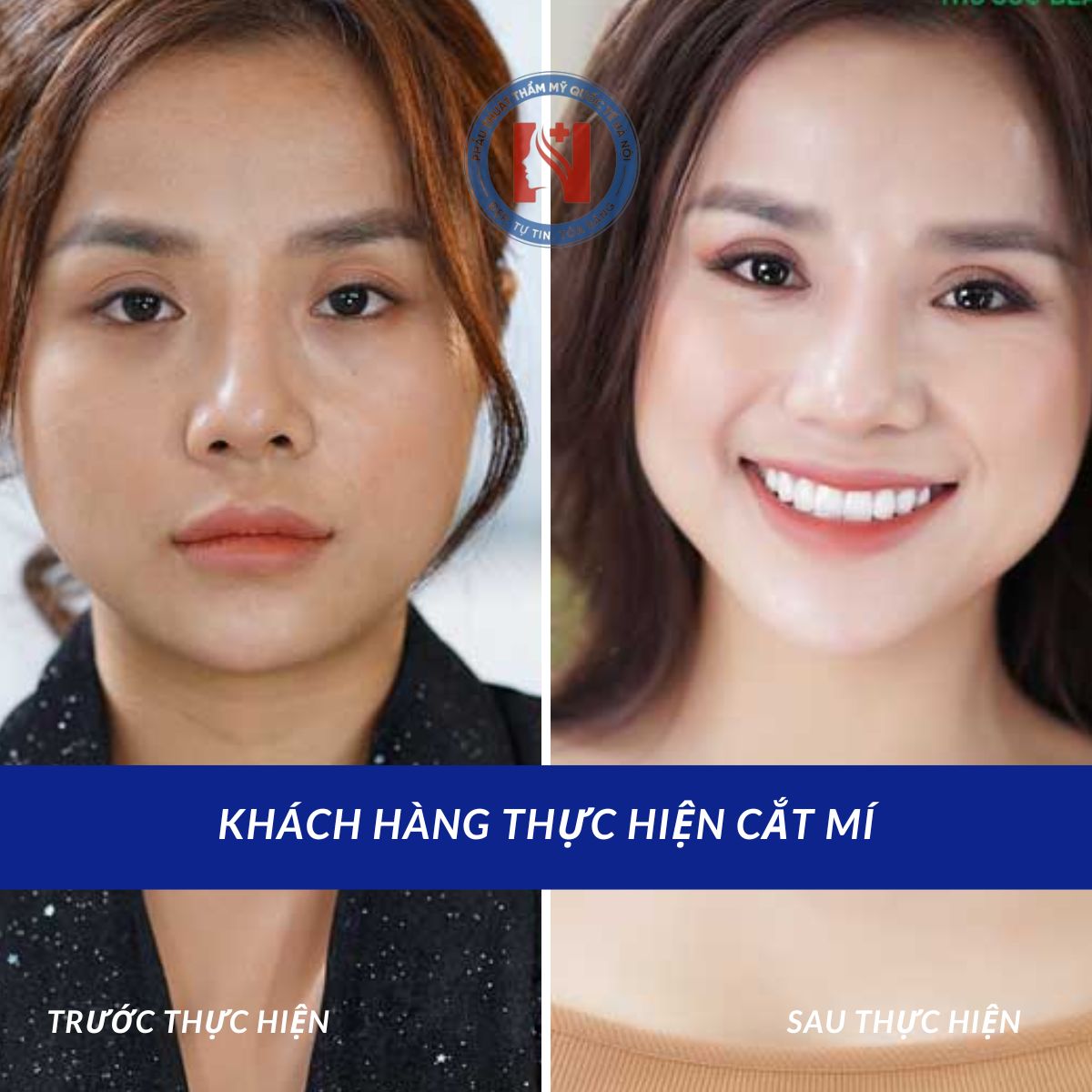 Khách hàng