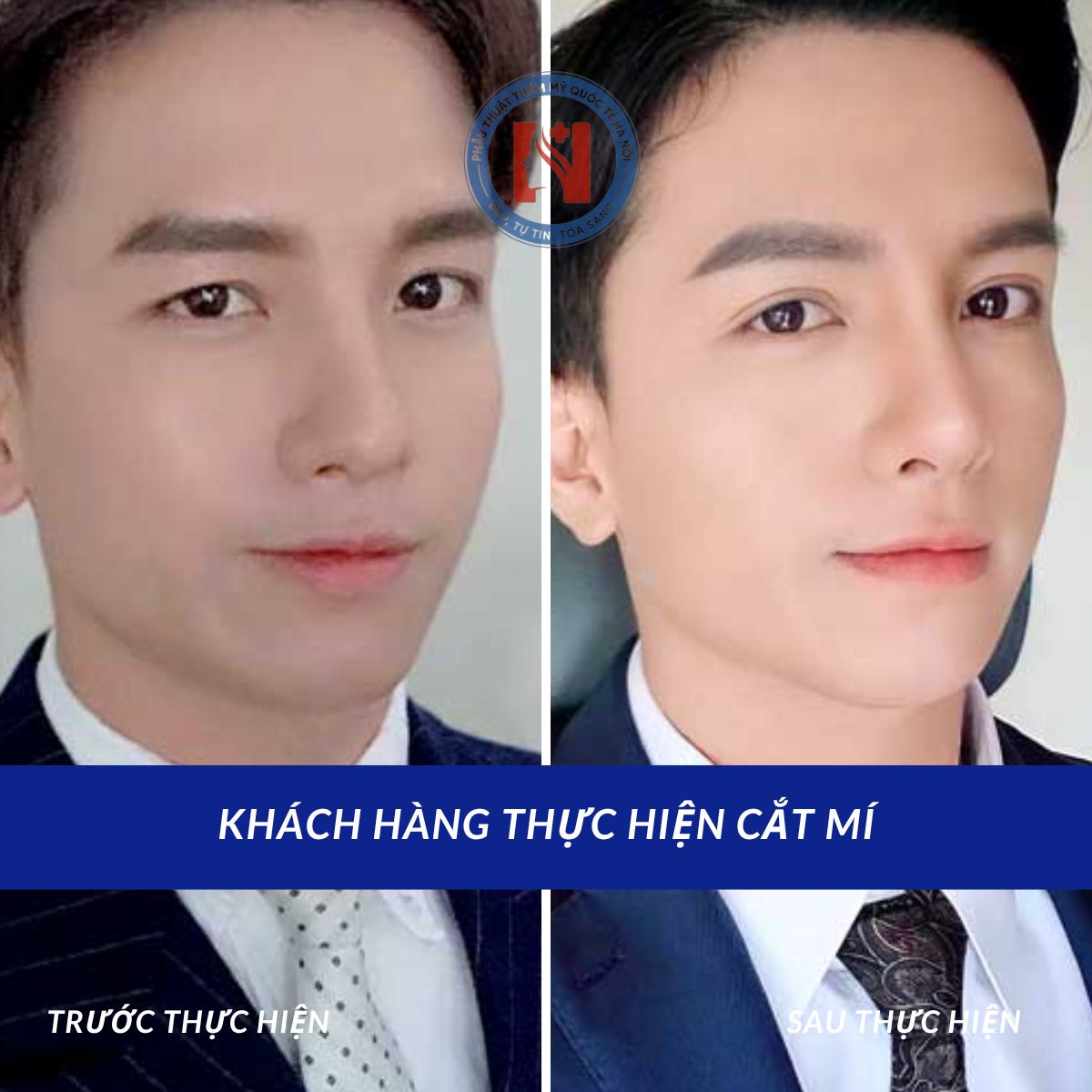 img-kh