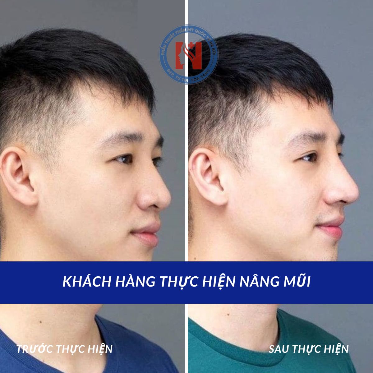 img-kh